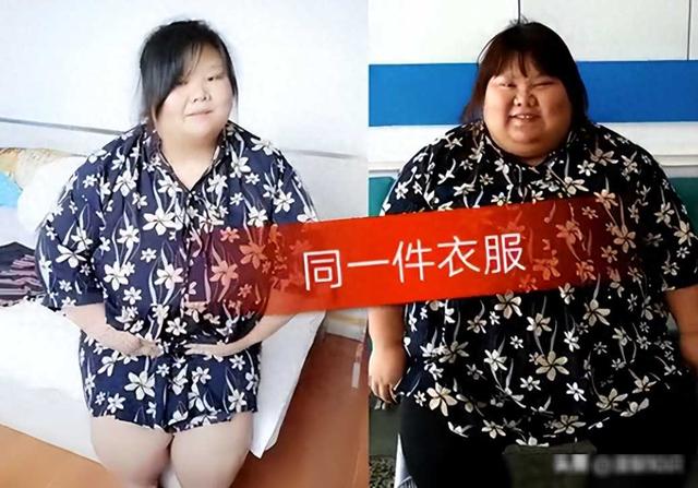 浙江美女校花5年前因被丈夫喂养至330斤，睡塌两张床，如今处