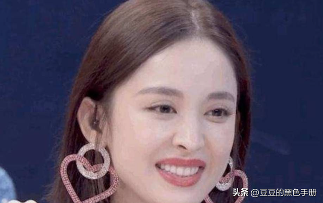 美女三分龅？看这9位女星，有人因一口牙毁所有，有人依旧美上天