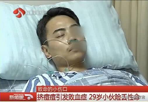 女孩挤了一颗痘，住进了ICU，医生：你挤痘的样子真可怕