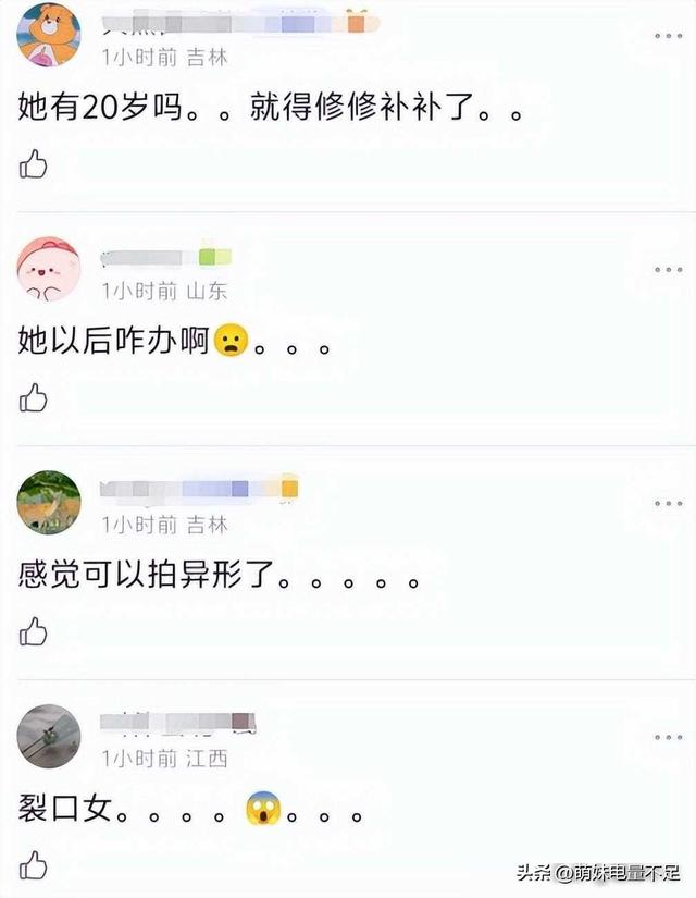 韩星张元英疑似整容事故，才19岁就撑不住了，面容崩坏神似裂口