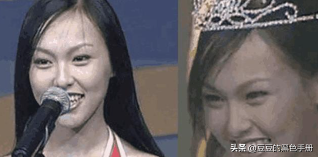 美女三分龅？看这9位女星，有人因一口牙毁所有，有人依旧美上天