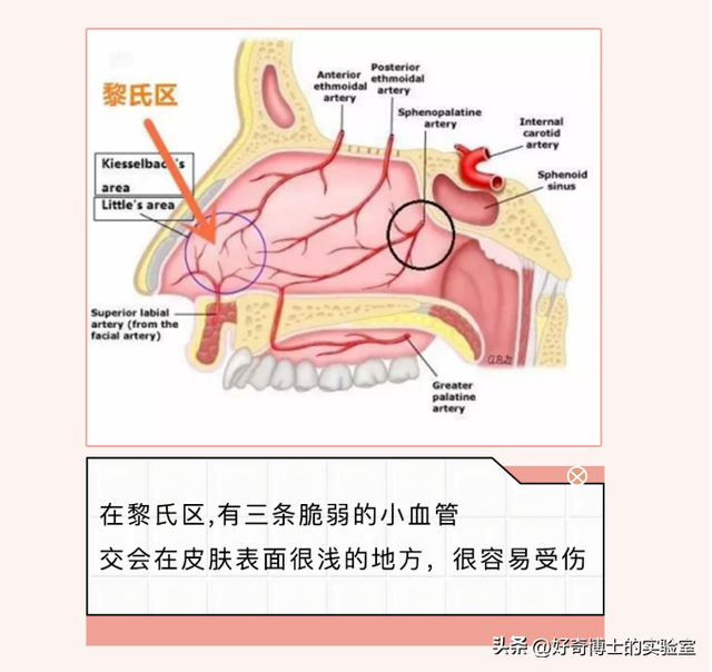 男人看到性感美女真的会流鼻血吗？