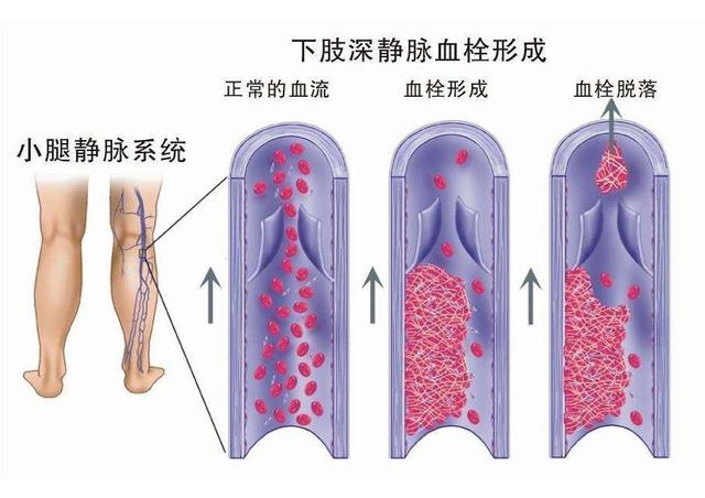 「健康」美女们！“大姨妈”来了千万别乱吃这种药！乱用药致一条腿“暴涨”还发红发烫……