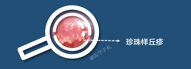 羞羞部位长了“珍珠样丘疹”：我很丑，但我很温柔