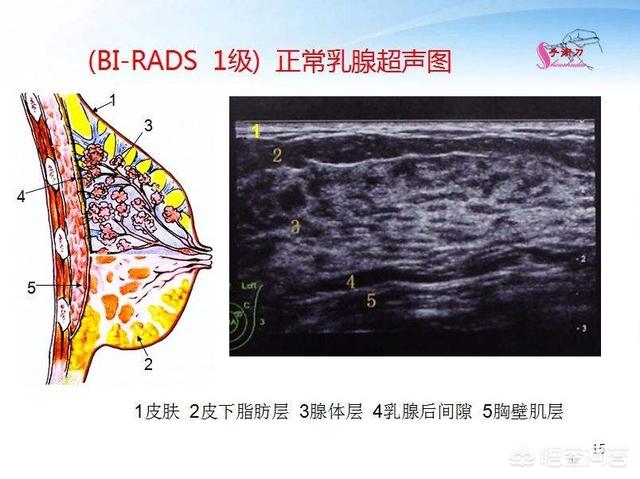 女性应该如何定期检查乳腺，都检查哪些项目？看文此文你就明白了