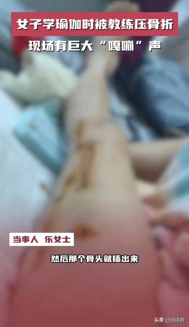 听着就疼！女子学瑜伽时被老师压断腿，现场有巨大“嘎嘣”声！