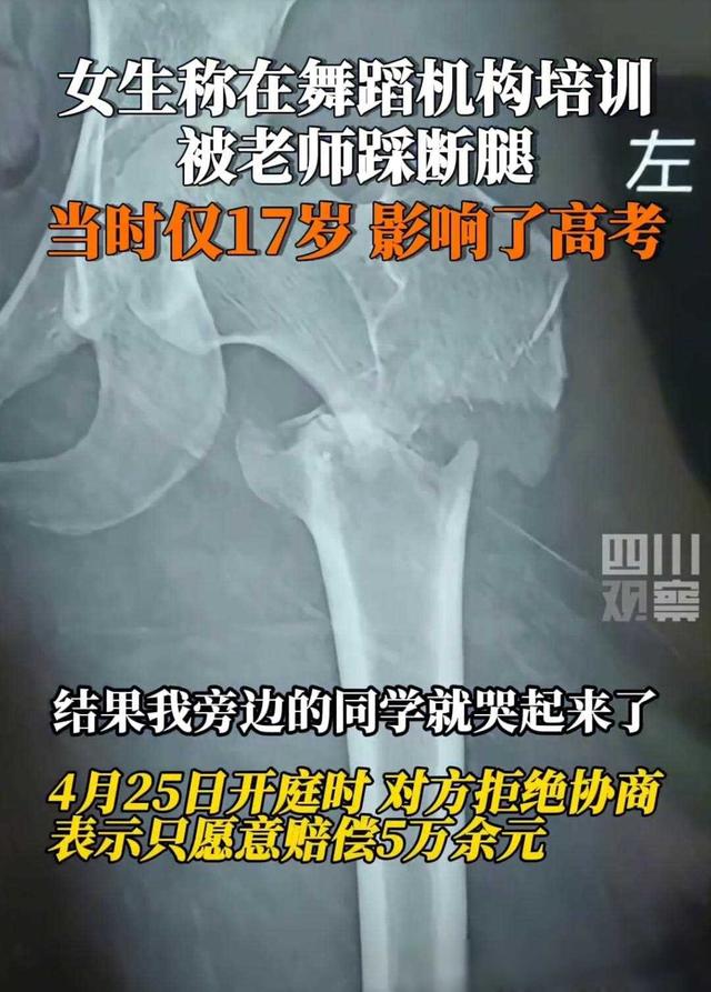 闹大了！揪心！17岁女孩开胯被舞蹈老师踩断腿，画面曝光，现场