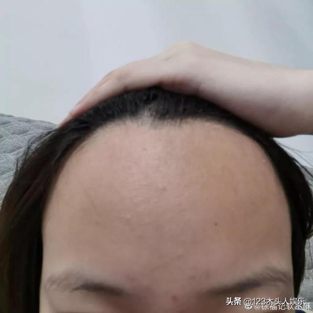 女生们集体晒出发际线，这发光的“脑门”在清朝就是阿哥啊