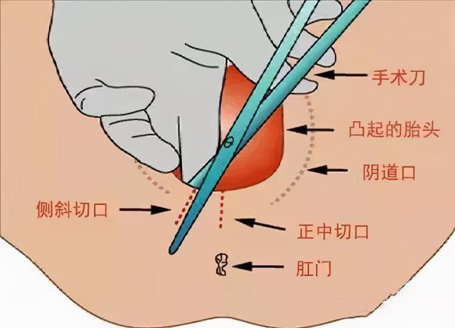 “会阴按摩”是搞黄色的？还是智商税？