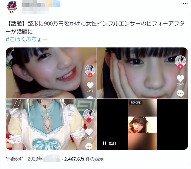 日本一15岁美少女整容失败变“蛇精”，幕后推手竟是她亲妈？！