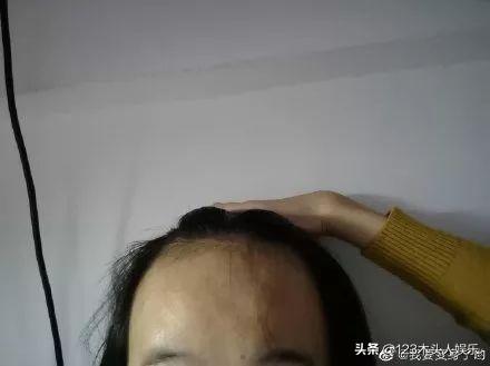 女生们集体晒出发际线，这发光的“脑门”在清朝就是阿哥啊