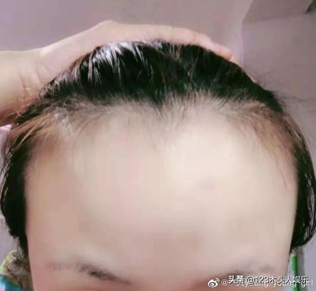 女生们集体晒出发际线，这发光的“脑门”在清朝就是阿哥啊