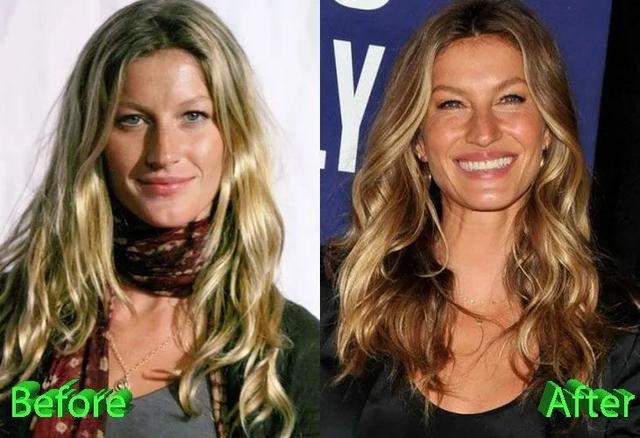 小品复习，当年Gisele Bündchen穿穆斯林长袍去整容