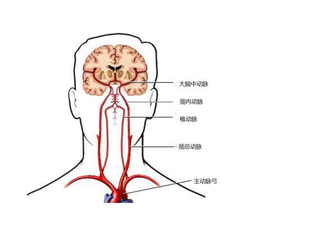 18岁美女模特全脑大面积脑梗，“一段时间”不喝水惹的祸？