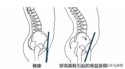 舒淇踩10cm高跟鞋摔倒脸着地，明星们为显高太拼了