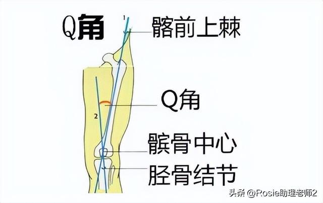 孙俪练瑜伽全身暴汗，腿粗臀肥的梨形身材如何瘦？做好这3步