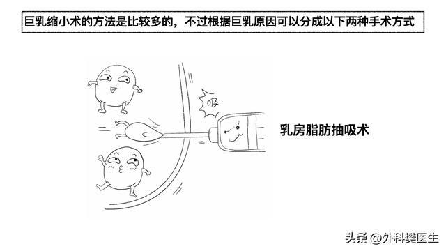 胖小木乳房发育，媳妇觉得太丑让他去整形，他说男人还能乳房整形