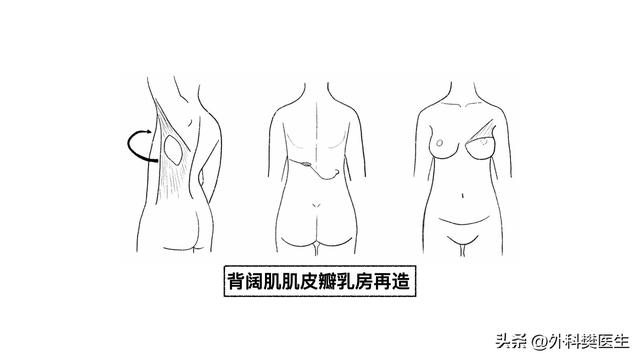 胖小木乳房发育，媳妇觉得太丑让他去整形，他说男人还能乳房整形