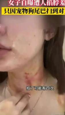 电梯美女打架(狗尾巴扫腿电梯内惊险打斗：23岁女子被扯下衣服，尺度爆炸)