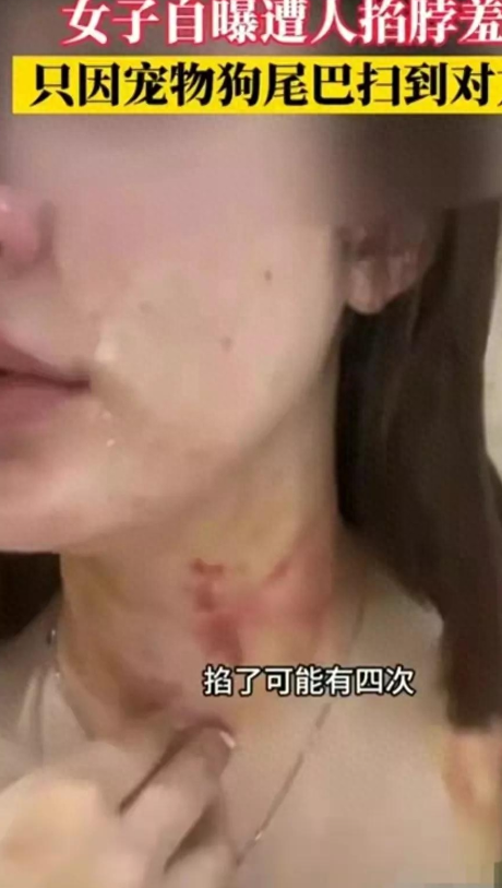 狗尾巴扫腿！电梯内惊险打斗：23岁女子被扯下衣服，尺度爆炸！