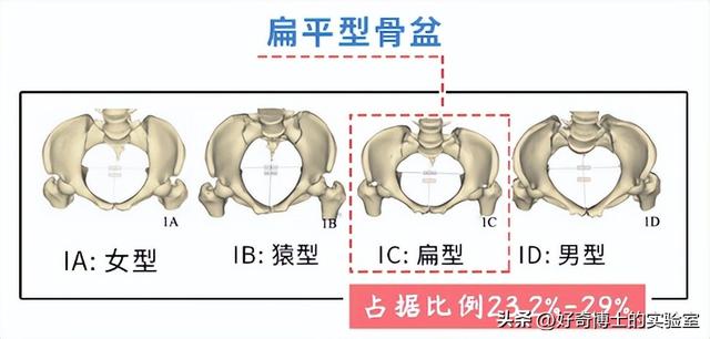 为什么很多女生屁股两侧，会有个小凸起？