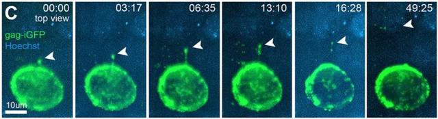 啪啪啪时艾滋病如何传染？科学家首次用实时成像技术记录下全过程