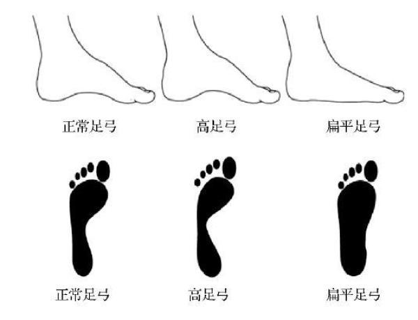 「提醒」罗马脚、希腊脚…连自己的脚都不了解，怪不得不舒服