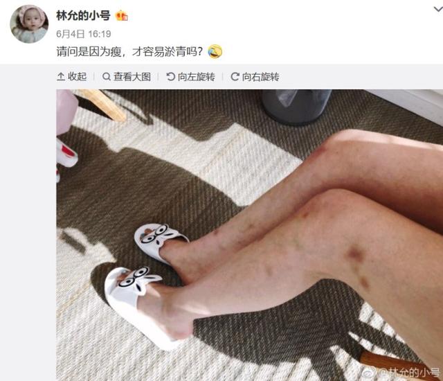 林允回应“撕脚皮”又怼网友？星女郎光环够她红一辈子吗？