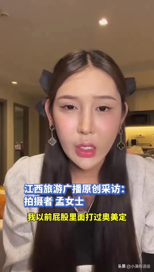 太可怕了！美女为丰臀打了400支玻尿酸，屁股里面化脓波及眼睛