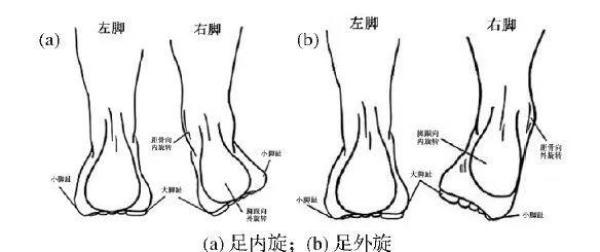 「提醒」罗马脚、希腊脚…连自己的脚都不了解，怪不得不舒服