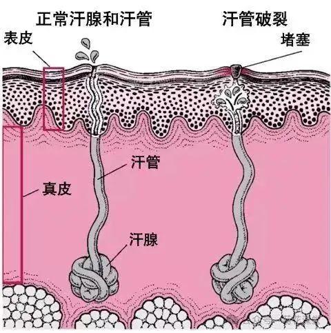 妻子总嫌他那里滂臭，一查真有大病！ 拖久了或致命