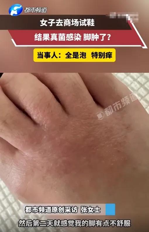 女子试完鞋后瘙痒难耐，密密麻麻全是……