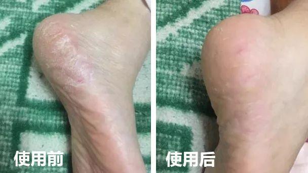 李沁的腿自带“丝袜特效”，双脚细嫩又光滑，修图都没这么夸张