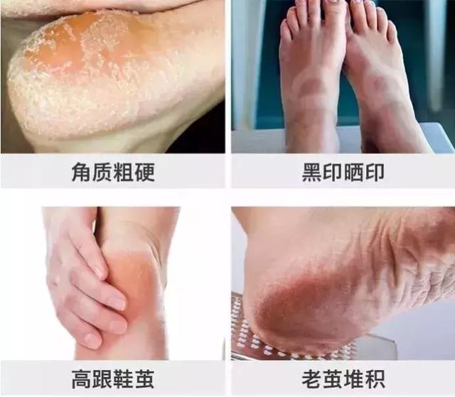 李沁的腿自带“丝袜特效”，双脚细嫩又光滑，修图都没这么夸张