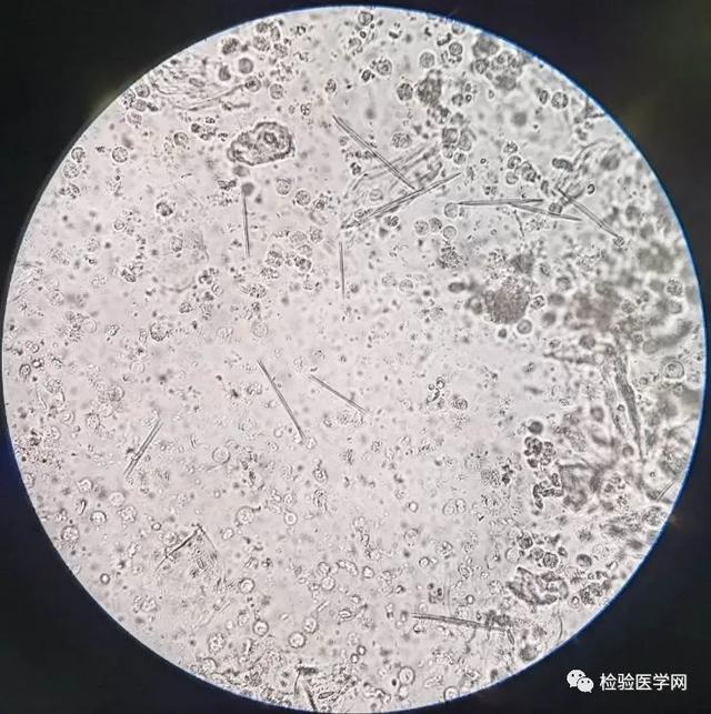 惊奇！粪便里还能发现“暗器”？