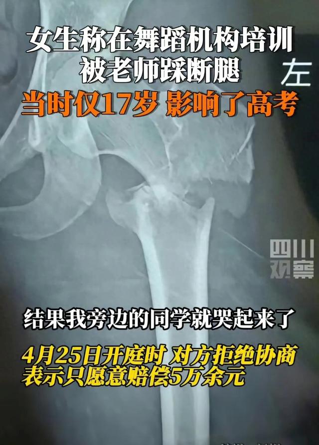 揪心！17岁女孩开胯被舞蹈老师踩断腿，画面曝光，现场听到骨头响